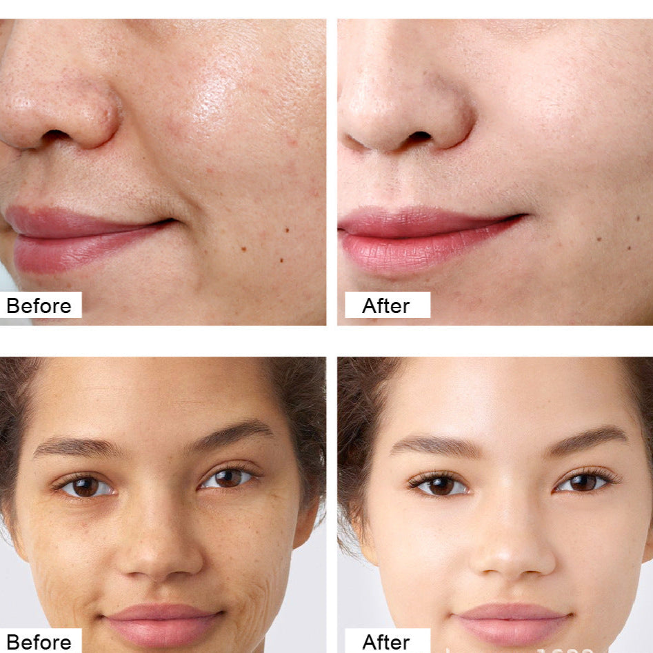 Retinol Facial Cream